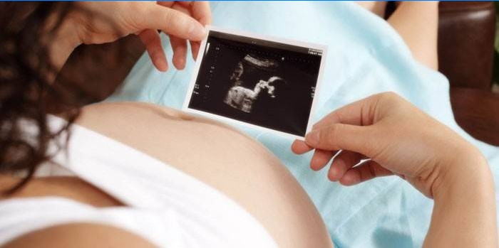 Hamile kadın ultrason taraması görünüyor